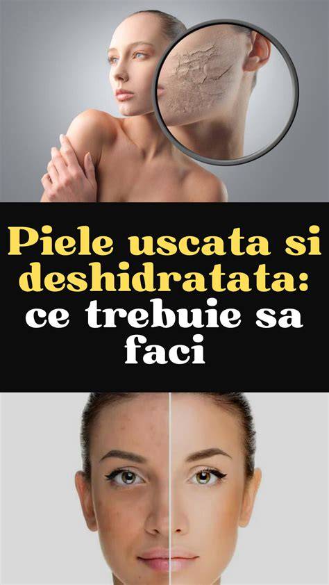 Grafic: cicatrice, hidratare, piele uscată vs. piele grasă cu argan