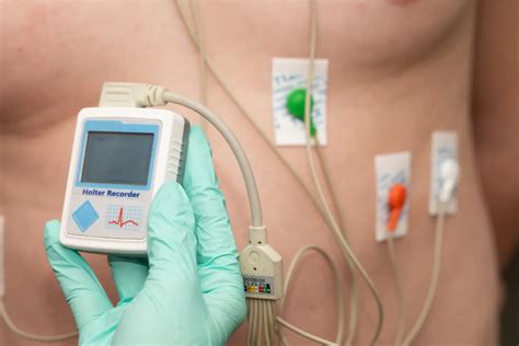 Holter 24h pentru monitorizarea ritmului cardiac