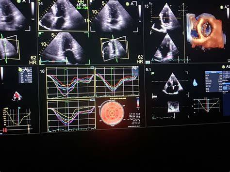 Ecografie cardiacă pentru copii - detalii procedură