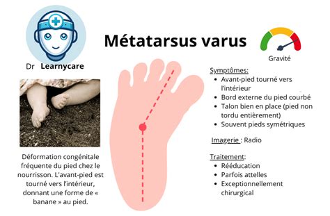 Poster: reprezentare vizuala a malpozitiilor piciorului (talus valgus, metatarsus varus, varus equin)