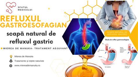 Diagramă: refluxul vizual și detecția strabismului