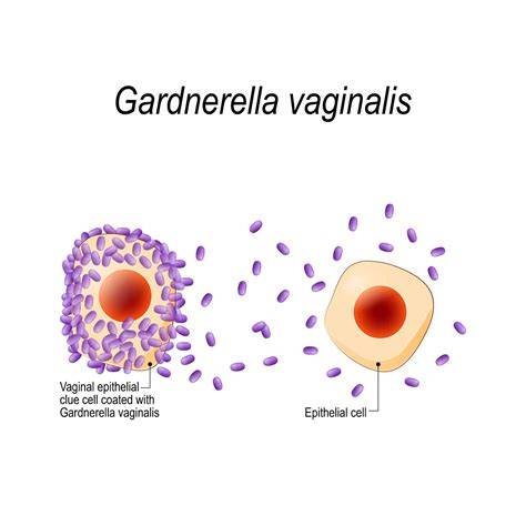 Infografic: echilibrul florei vaginale si rolul Gardnerella vaginalis