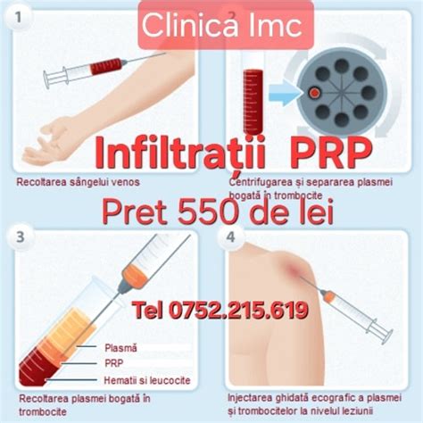 Imagine ilustrand principiul PRP: prelevarea sangelui, procesarea si injectarea in zona afectata