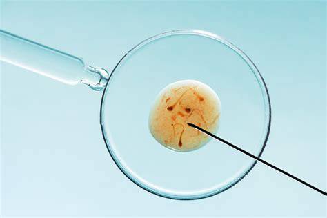 Legenda procesului de fertilizare in vitro: intrarea in zona, activarea ovocitului, reactie acrozomală, legare la zona pellucida, formarea pronucleelor, zona pellucida, spatiul vitelin