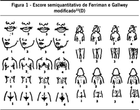 schemă a scorului Ferriman-Gallwey