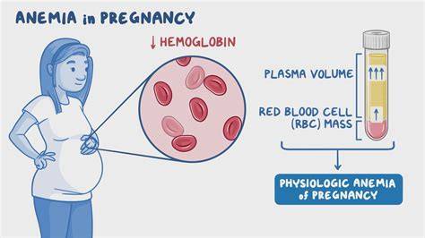 infographic anemia during pregnancy