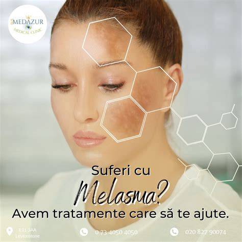 Infografic: efectele tratamentelor cosmetice în sarcină și stadiile Melasma