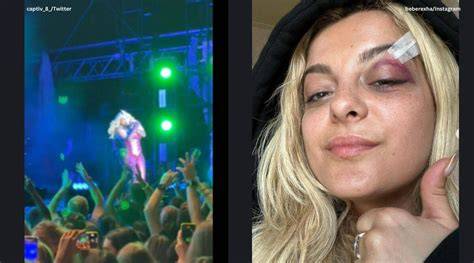 Diagrame: etapele mari din cariera Bebe Rexha