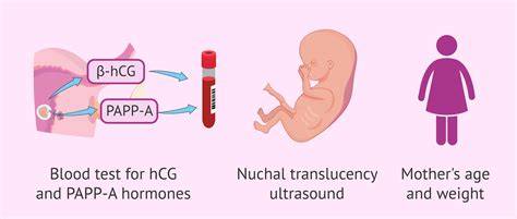 Screening prenatal cu free beta-hCG și PAPP-A