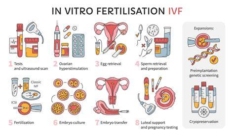 Schema procesului FIV: de la inseminare la transplant