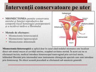 Imagine generala a chiuretajului uterin: instrumente, endometru, etape