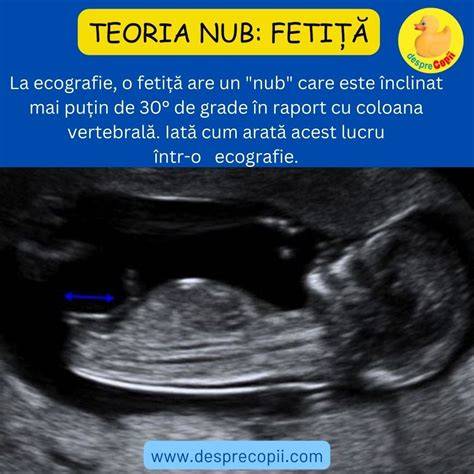 Diagramă: ecografia de determinare a sexului în săptămânile 18-22