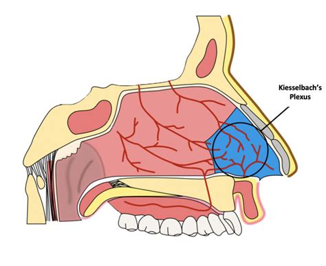 diagramă: zonele nazale și locul obișnuit al epistaxisului (zona Kisselbach)
