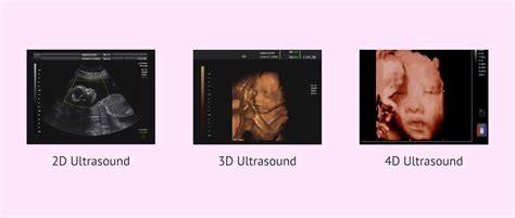 Ecografie 3D/4D si teste specifice pentru adolescente si adulte