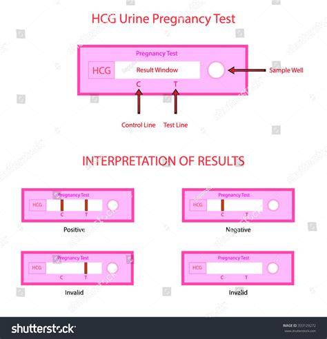 Infografic: Diferențe între „pregnancy test”, „urine pregnancy test” și „hCG test”