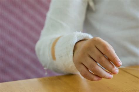 Copil cu o fractura de membru primind îngrijiri