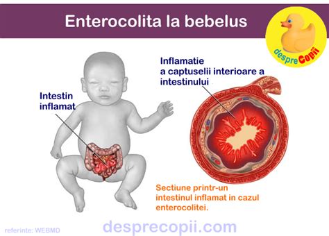 Copil cu simptome de enterocolita