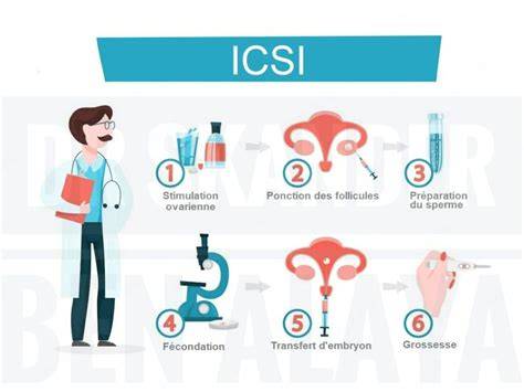 Infografic: etapele procesului FIV cu ICSI, de la stimularea ovariană până la transferul embrionar