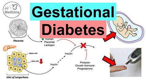 Diagram: Calea tratamentului diabet gestational