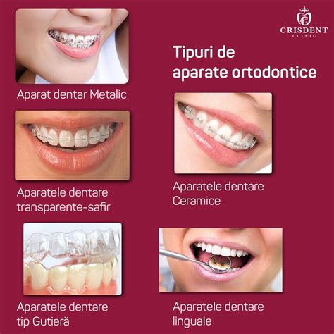 Infographic: Tipuri de suzete, forme ortodontice și materiale
