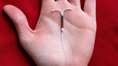 Procedura montare sterilet