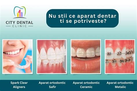Exemplu de aparat dentar invizibil