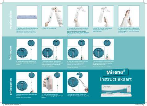 Schema procedurii de insertie Mirena in cabinet