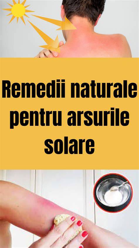 Infografie: măsuri generale pentru arsurile solare la copii