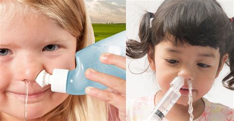 Diagramă comparativă a medicamentelor nazale