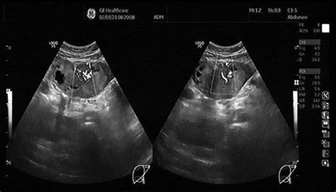 Ecografie normală a colonului ventral stâng la cal