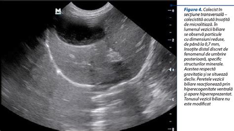 Aspecte ecografice ale diferitelor segmente ale colonului la cal