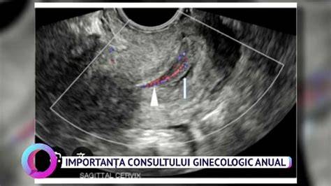 Diagrame si infografic despre fluxul consultului ginecologic si obstetric