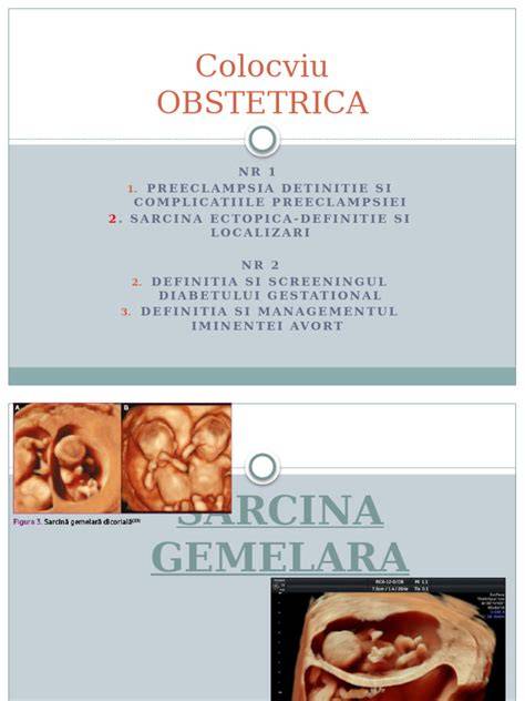 Explicatii medicale despre sarcina gemelara si risc