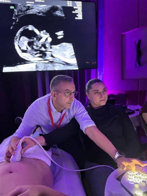 ecografie obstetricală Voluson E8 în cabinet