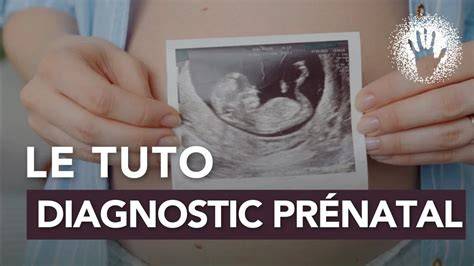 Hartă aprotocolului diagnostic prenatal si a pașilor amniocentezei