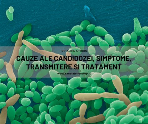 Ilustrație a simptomelor candidozei vaginale