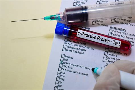 Informații despre testul CRP