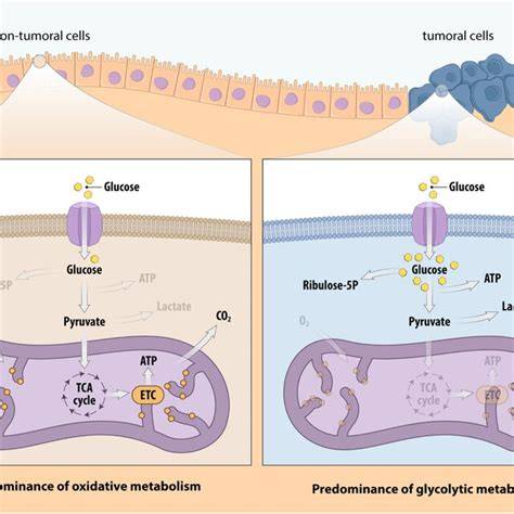 Schema screeningului metabolic extins