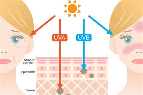 Schema cu efectele razelor UV asupra pielii