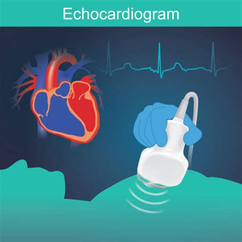 ecografie cardiacă pediatrică - infografic cu pași de interpretare