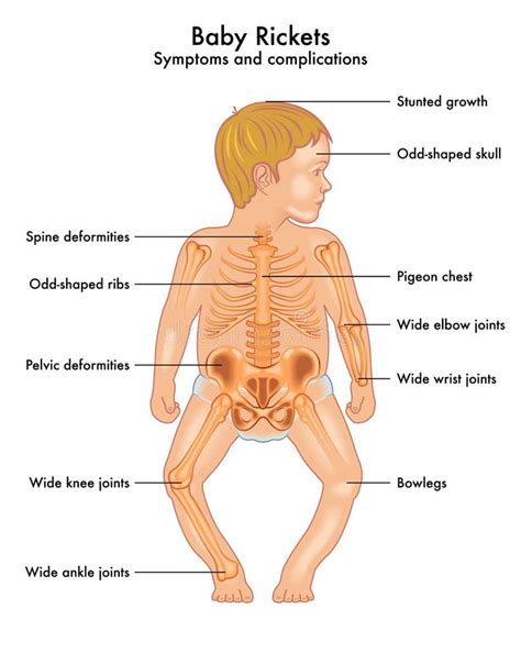 Schema anatomiei șoldului unui copil
