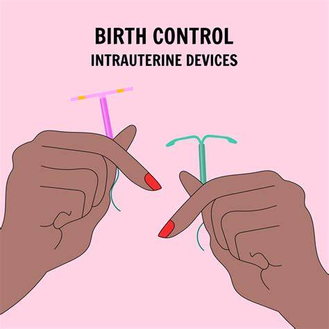 Infografic: Steriletul ca metodă de contracepție - tipuri, durată și recomandări