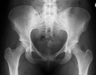 Imagine ilustrativă: radiografie bazin