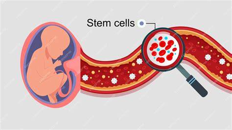recoltare-celule-stem-cordon-ombilical