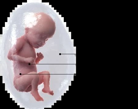 Ilustrație a pozițiilor fetale