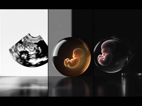 Infografie: Tipuri de ecografii în obstetrică