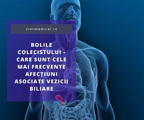 Infografic: mecanismul colicii biliare, localizarea durerii și rolul colecistului