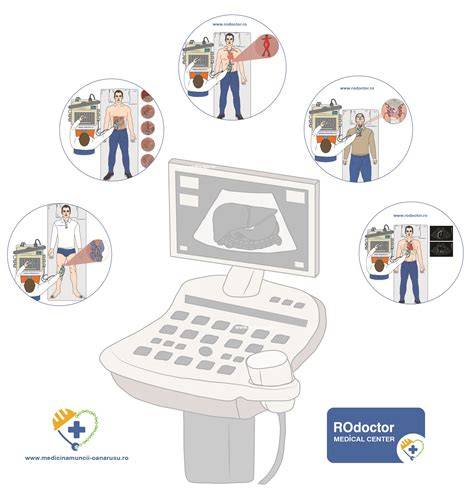 Infographics: scheme de monitorizare PVH-IVH si program de ecografii seriate
