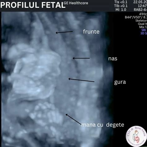 Infographic: Ciclul îngrijirii prenatale pe trimestrul I-III