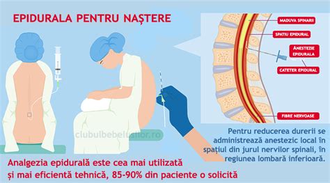 Ilustrație a punctelor de administrare pentru anestezia spinală și epidurală